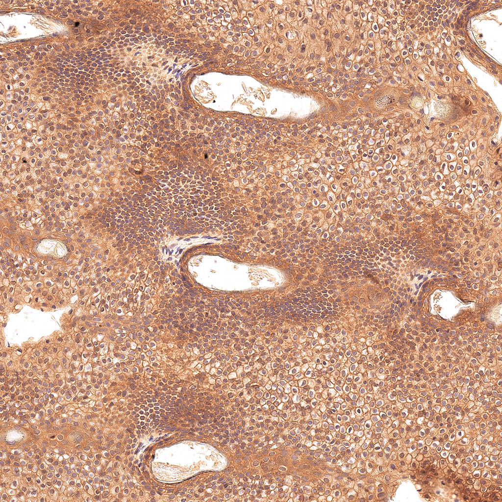 sars-cov-2 gene expression in a human fetus